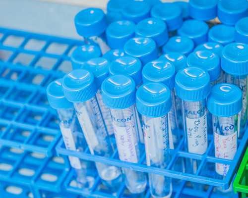 湖北武汉供卵医院,武汉协和医院卵子库申请供卵要排队等多久？