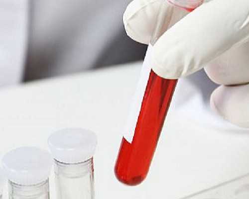 试管婴儿冷冻胚胎优势是什么？~借卵助孕